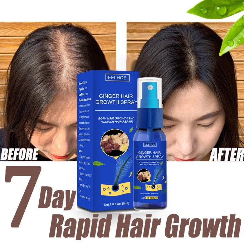 Ginger Hair Growth spray Anti Hair Fall Hair Loss Treatment Growth Essence Oil for Men Women