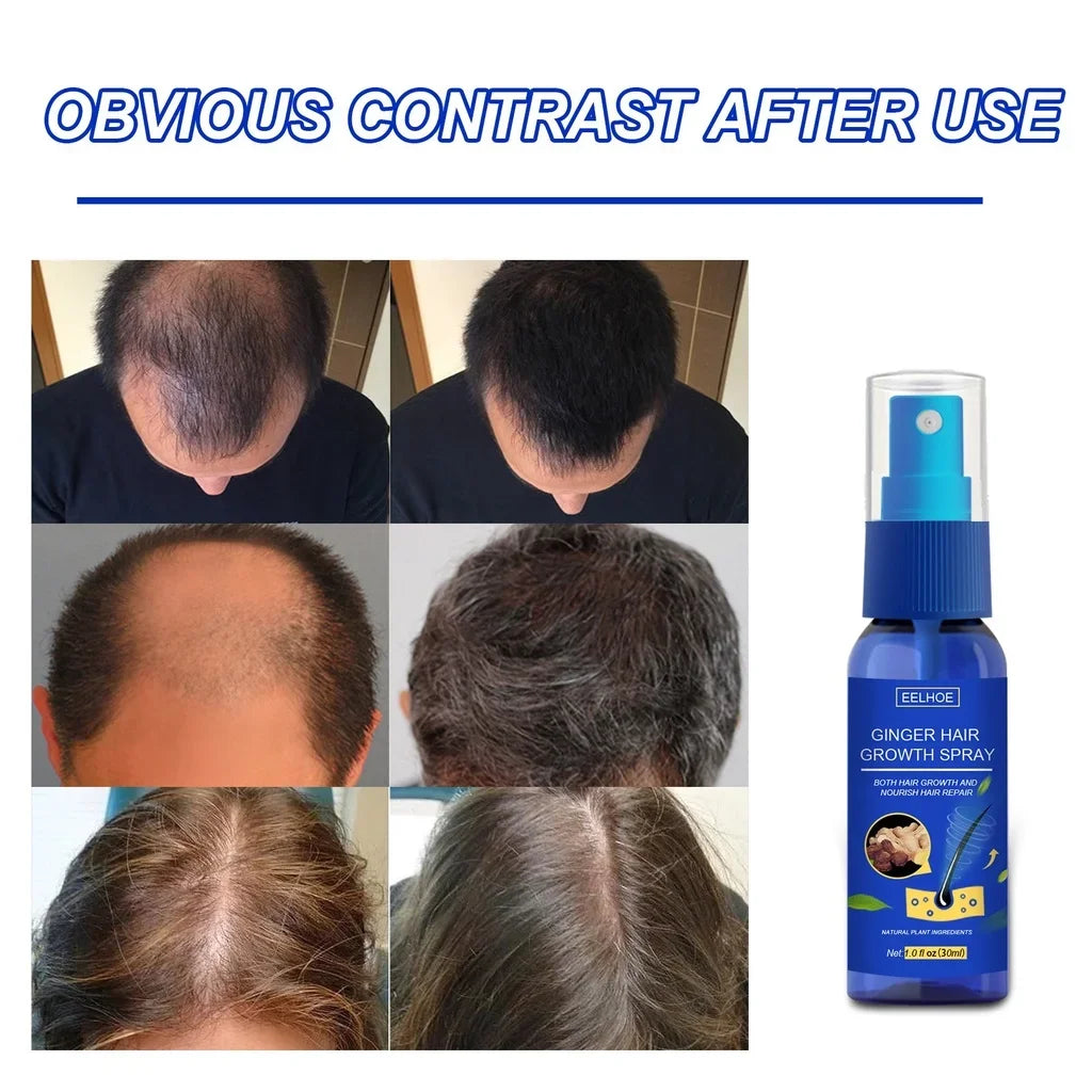Ginger Hair Growth spray Anti Hair Fall Hair Loss Treatment Growth Essence Oil for Men Women
