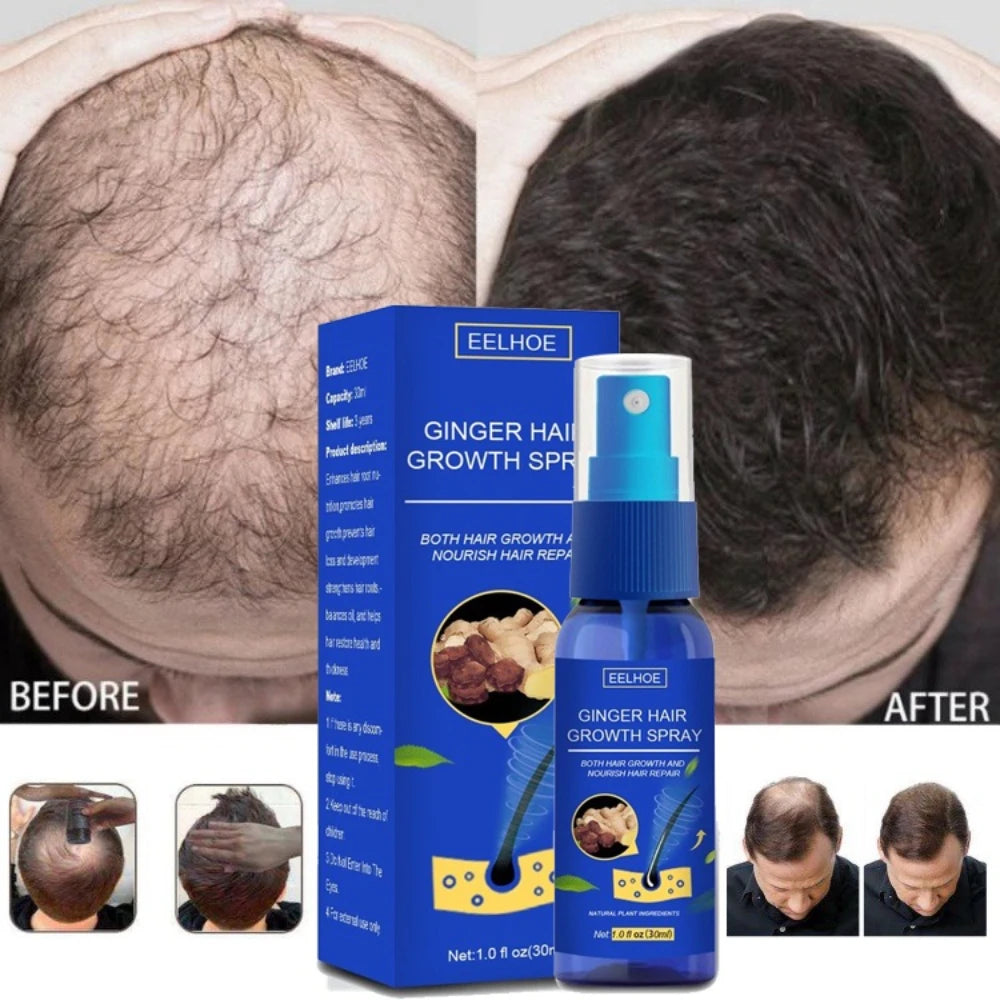 Ginger Hair Growth spray Anti Hair Fall Hair Loss Treatment Growth Essence Oil for Men Women
