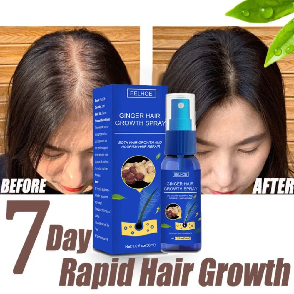 Ginger Hair Growth spray Anti Hair Fall Hair Loss Treatment Growth Essence Oil for Men Women