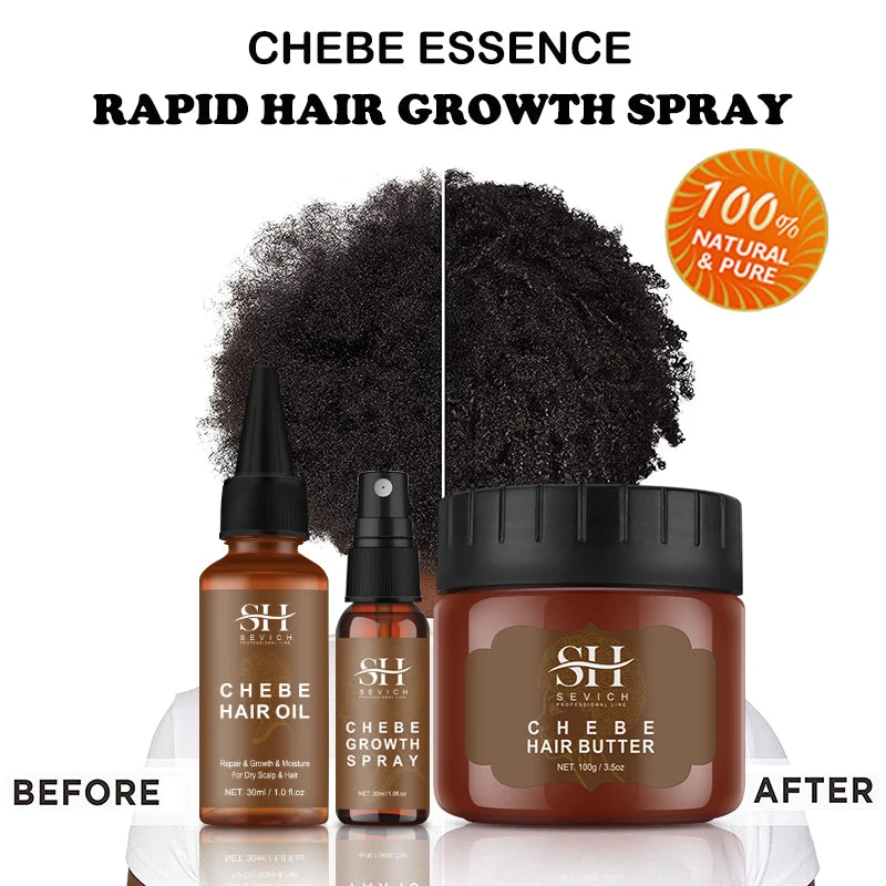 Chebe Traktionsalopezie Verdickungsöl Anti-Haarausfall-Behandlungsspray Verrückt Schnelles Haarwachstum Produkte Sevich Anti-Haarbruch Haarpflege
